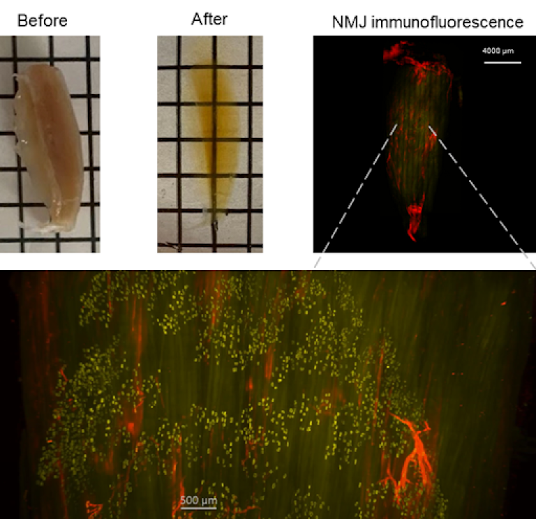 Image: muscle before and after tissue clearing, then following staining and imaging the neuromuscular junctions (NMJ; yellow) and terminal nerves (red), can be visualized throughout the entire muscle